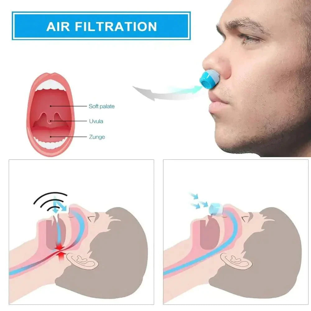 Micro CPAP Sleep Apnea Machine – Travel, Anti Snoring